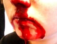 “ ...HAVERÁ PESTES” (Mt 24,7)    Surge doença desconhecida que faz pessoas sangrarem pelos olhos, nariz e boca. 