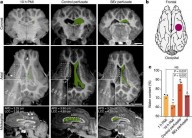 Cientistas ressuscitam células do cérebro de porcos mortos